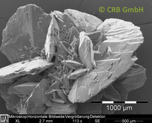 Kidney stones of calcium oxalate | © CRB Analyse Service GmbH