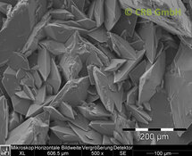 Kidney stones of calcium oxalate | © CRB Analyse Service GmbH