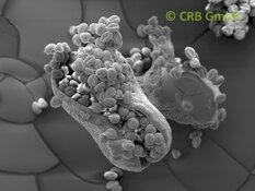 Broken seed capsule of Euphorbia leuconeura | © CRB Analyse Service GmbH