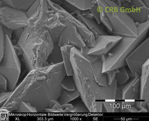 Kidney stones of calcium oxalate | © CRB Analyse Service GmbH